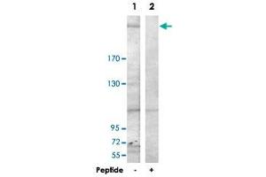 Western blot analysis of extracts from HepG2 cells, using LAMB1 polyclonal antibody . (Laminin beta 1 抗体  (C-Term))