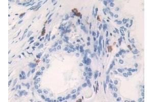 Detection of KLK6 in Human Prostate Tissue using Polyclonal Antibody to Kallikrein 6 (KLK6) (Kallikrein 6 抗体  (AA 17-244))