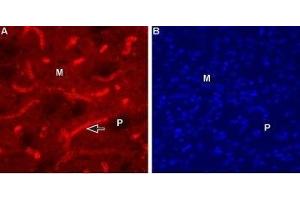 Expression of Muscarinic acetylcholine receptor M1 in mouse striatum - Immunohistochemical staining of mouse striatum using Anti-CHRM1 (443-458) Antibody (ABIN7043061, ABIN7044590 and ABIN7044591), (1:100). (CHRM1 抗体  (Intracellular))