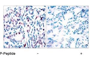 Image no. 1 for anti-Signal Transducer and Activator of Transcription 3 (Acute-Phase Response Factor) (STAT3) (pTyr705) antibody (ABIN196691) (STAT3 抗体  (pTyr705))