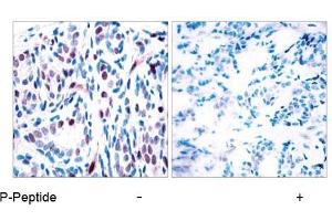 Image no. 1 for anti-Signal Transducer and Activator of Transcription 3 (Acute-Phase Response Factor) (STAT3) (pTyr705) antibody (ABIN196690)