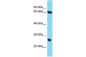 Host: Rabbit Target Name: C22orf23 Sample Type: HepG2 Whole Cell lysates Antibody Dilution: 1. (C22orf23 抗体  (Middle Region))