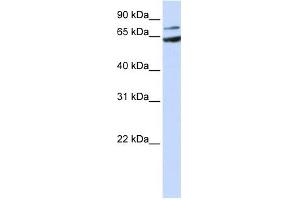 FZD8 antibody used at 1 ug/ml to detect target protein. (FZD8 抗体)