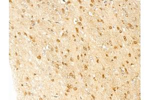 ABIN7094856 and ABIN7098907 at 1/100 staining Rat brain tissue by IHC-P.
