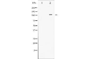 Western blot analysis of HDAC4 phosphorylation expression in CalyculinA treated Jurkat whole cell lysates,The lane on the left is treated with the antigen-specific peptide.