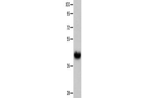 Western Blotting (WB) image for anti-Urotensin 2 Receptor (UTS2R) antibody (ABIN2426016) (UTS2R 抗体)