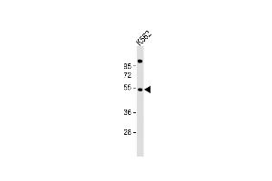 Anti-EIF2B3 Antibody (C-term) at 1:1000 dilution + K562 whole cell lysate Lysates/proteins at 20 μg per lane. (EIF2B3 抗体  (C-Term))