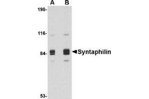 Western blot analysis of Syntaphilin in rat brain tissue lysate with this product at (A) 1 and (B) 2 μg/ml. (Syntaphilin 抗体  (Center))