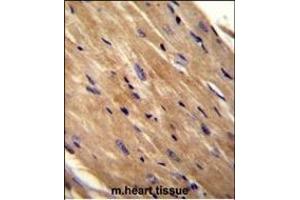 RHOJ Antibody (Center) (ABIN655708 and ABIN2845159) immunohistochemistry analysis in formalin fixed and paraffin embedded mouse heart tissue followed by peroxidase conjugation of the secondary antibody and DAB staining. (RHOJ 抗体  (AA 131-159))