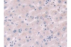 Detection of NQO1 in Human Liver Tissue using Polyclonal Antibody to NADH Dehydrogenase, Quinone 1 (NQO1) (NQO1 抗体  (AA 2-274))