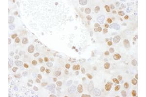 Immunohistochemistry (IHC) image for anti-TAR DNA Binding Protein (TARDBP) (AA 250-300) antibody (ABIN7454906) (TARDBP 抗体  (AA 250-300))