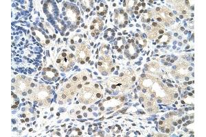 CACNB1 antibody was used for immunohistochemistry at a concentration of 4-8 ug/ml to stain Epithelial cells of renal tubule (arrows) in Human Kidney. (CACNB1 抗体  (Middle Region))