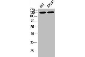 Western Blot analysis of 453 AD293 cells using Phospho-PERK (T981) Polyclonal Antibody (PERK 抗体  (pThr981))