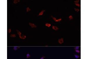 Immunofluorescence analysis of HeLa cells using BMPR2 Polyclonal Antibody at dilution of 1:100. (BMPR2 抗体)