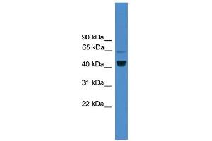 WB Suggested Anti-ZRANB2 Antibody Titration:  0. (ZNF265 抗体  (Middle Region))
