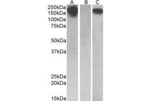 Western Blotting (WB) image for anti-Colony Stimulating Factor 1 Receptor (CSF1R) (Internal Region) antibody (ABIN2464715) (CSF1R 抗体  (Internal Region))