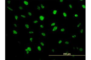 Immunofluorescence of monoclonal antibody to ZFHX1B on HeLa cell. (ZEB2 抗体  (AA 1115-1214))