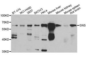 Western blot analysis of extracts of various cell lines, using GNS antibody. (GNS 抗体)