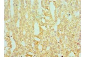 Immunohistochemistry (IHC) image for anti-serpin Peptidase Inhibitor, Clade A (Alpha-1 Antiproteinase, Antitrypsin), Member 1 (SERPINA1) (AA 165-444) antibody (ABIN7166367)