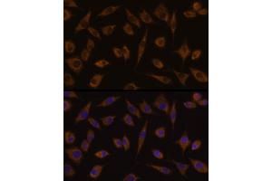 Immunofluorescence analysis of L929 cells using UGT1 Rabbit pAb (359) at dilution of 1:100 (40x lens). (UGT1A1 抗体  (AA 1-200))