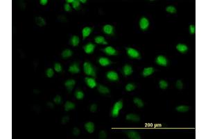 Immunofluorescence of monoclonal antibody to ALS2CR8 on HeLa cell. (Calcium Responsive Transcription Factor (CARF) (AA 621-718) 抗体)