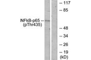 Western blot analysis of extracts from COS7 cells treated with TNF-alpha, using NF-kappaB p65 (Phospho-Thr435) Antibody. (NF-kB p65 抗体  (pThr435))
