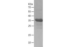 Western Blotting (WB) image for Small Ubiquitin Related Modifier 2 (SUMO2) (AA 1-93) protein (His-IF2DI Tag) (ABIN7283877) (SUMO2 Protein (AA 1-93) (His-IF2DI Tag))