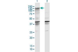 Western Blot analysis of ENPP2 expression in transfected 293T cell line by ENPP2 MaxPab polyclonal antibody. (ENPP2 抗体  (AA 1-863))
