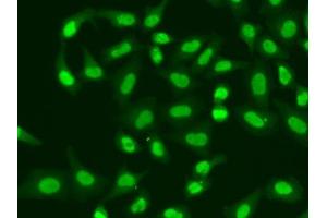 Immunofluorescence analysis of A549 cells using APTX antibody. (Aprataxin 抗体  (AA 93-342))