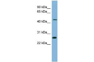 WB Suggested Anti-UPB1  Antibody Titration: 0. (UPB1 抗体  (Middle Region))