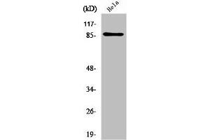Western Blot analysis of HeLa cells using UTP14A Polyclonal Antibody (UTP14A 抗体  (Internal Region))