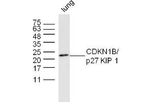 Mouse lung lysates probed with CDKN1B Polyclonal Antibody, unconjugated  at 1:300 overnight at 4°C followed by a conjugated secondary antibody at 1:10000 for 60 minutes at 37°C. (CDKN1B 抗体  (AA 150-198))