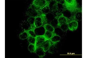 Immunofluorescence of monoclonal antibody to LAMB3 on A-431 cell. (Laminin beta 3 抗体  (AA 1064-1171))