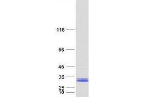 Western Blotting (WB) image for HscB Iron-Sulfur Cluster Co-Chaperone Homolog (HSCB) protein (Myc-DYKDDDDK Tag) (ABIN2723069)
