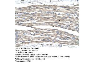 Rabbit Anti-GPR161 Antibody  Paraffin Embedded Tissue: Human Muscle Cellular Data: Skeletal muscle cells Antibody Concentration: 4. (GPR161 抗体  (Middle Region))
