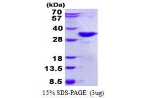 Dickkopf 2 Homolog (DKK2) (AA 34-259) protein (His tag)