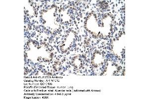 Rabbit Anti-FLJ12529 Antibody  Paraffin Embedded Tissue: Human Lung Cellular Data: Alveolar cells Antibody Concentration: 4. (CPSF7 抗体  (C-Term))