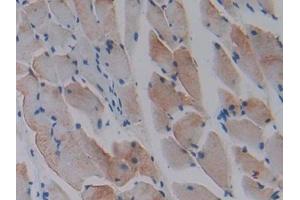 DAB staining on IHC-P; Samples: Mouse Skeletal muscle Tissue (CCL9 抗体  (AA 22-122))