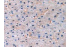 Immunohistochemistry (IHC) image for anti-CAP, Adenylate Cyclase-Associated Protein 1 (CAP1) (AA 33-218) antibody (ABIN7436249)