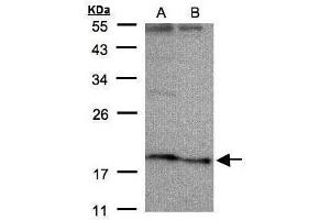 WB Image Sample(30 μg of whole cell lysate) A:HeLa S3, B:Hep G2, 12% SDS PAGE antibody diluted at 1:500 (SCN3B 抗体  (Center))