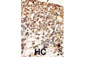 Immunohistochemistry (IHC) image for anti-PKA C-Alpha,PKA C-beta antibody (ABIN3002928) (PKA C-Alpha,PKA C-beta 抗体)