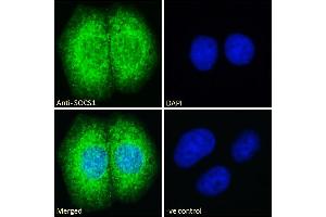 ABIN184575 Immunofluorescence analysis of paraformaldehyde fixed MCF7 cells, permeabilized with 0.