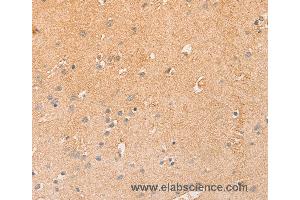 Immunohistochemistry of Human brain  using CCL16  Polyclonal Antibody at dilution of 1:50 (CCL16 抗体)