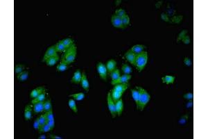 Immunofluorescent analysis of HepG2 cells using ABIN7149353 at dilution of 1:100 and Alexa Fluor 488-congugated AffiniPure Goat Anti-Rabbit IgG(H+L) (NCK2 抗体  (AA 1-380))