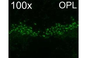Indirect immunostaining of ribbon synapses in the outer plexiform layer of PFA mouse retina (dilution 1 : 1000). (RIMS2 抗体  (AA 461-987))