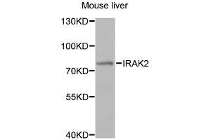Western blot analysis of extracts of mouse liver, using IRAK2 antibody. (IRAK2 抗体)