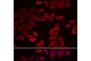 Immunofluorescence analysis of HeLa cells using SEPHS1 Polyclonal Antibody (SEPHS1 抗体)