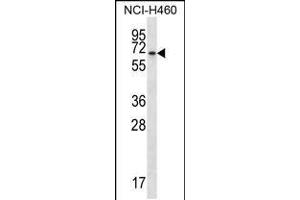 Western blot analysis in NCI-H460 cell line lysates (35ug/lane). (BEND4 抗体  (N-Term))