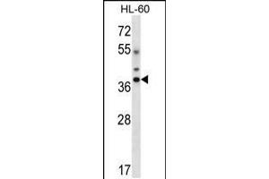 Western blot analysis in HL-60 cell line lysates (35ug/lane). (DLX5 抗体  (AA 100-128))