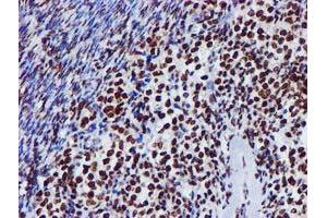 Image no. 2 for anti-Glutathione S-Transferase theta 2 (GSTT2) antibody (ABIN1498553) (GSTT2 抗体)